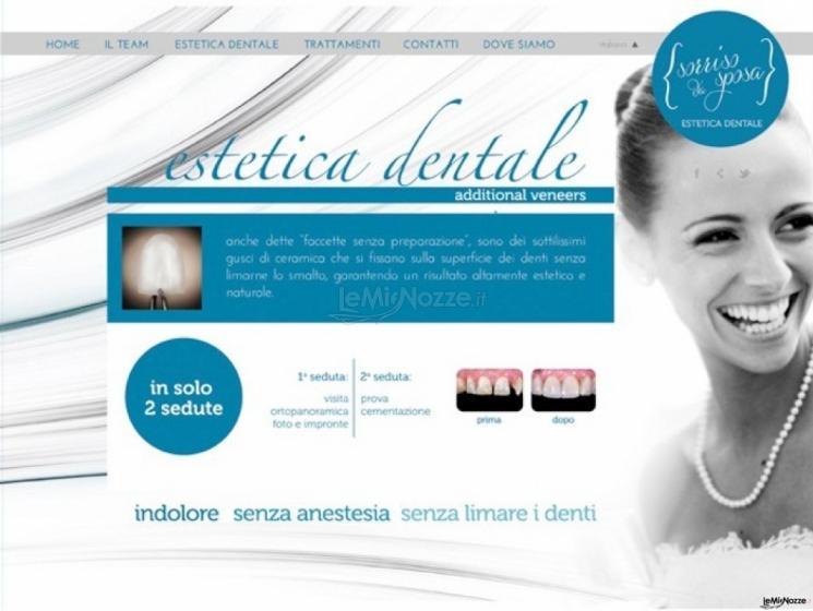 Sorriso da sposa - Estetica dentale